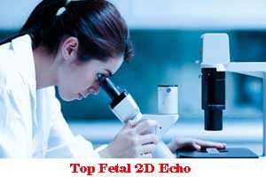 Top Fetal 2D Echo In Gamma Greater Noida