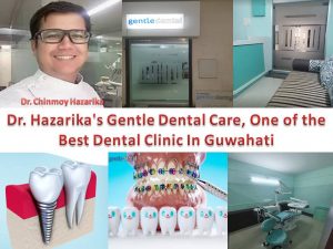 Dr. Hazarika's Gentle Dental Care, One of the Best Dental Clinic In Christian Basti Guwahati